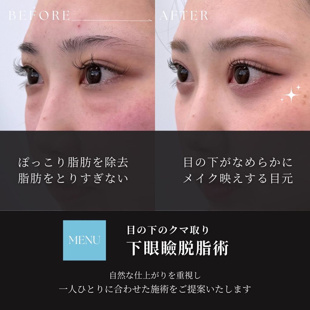 廣瀬001