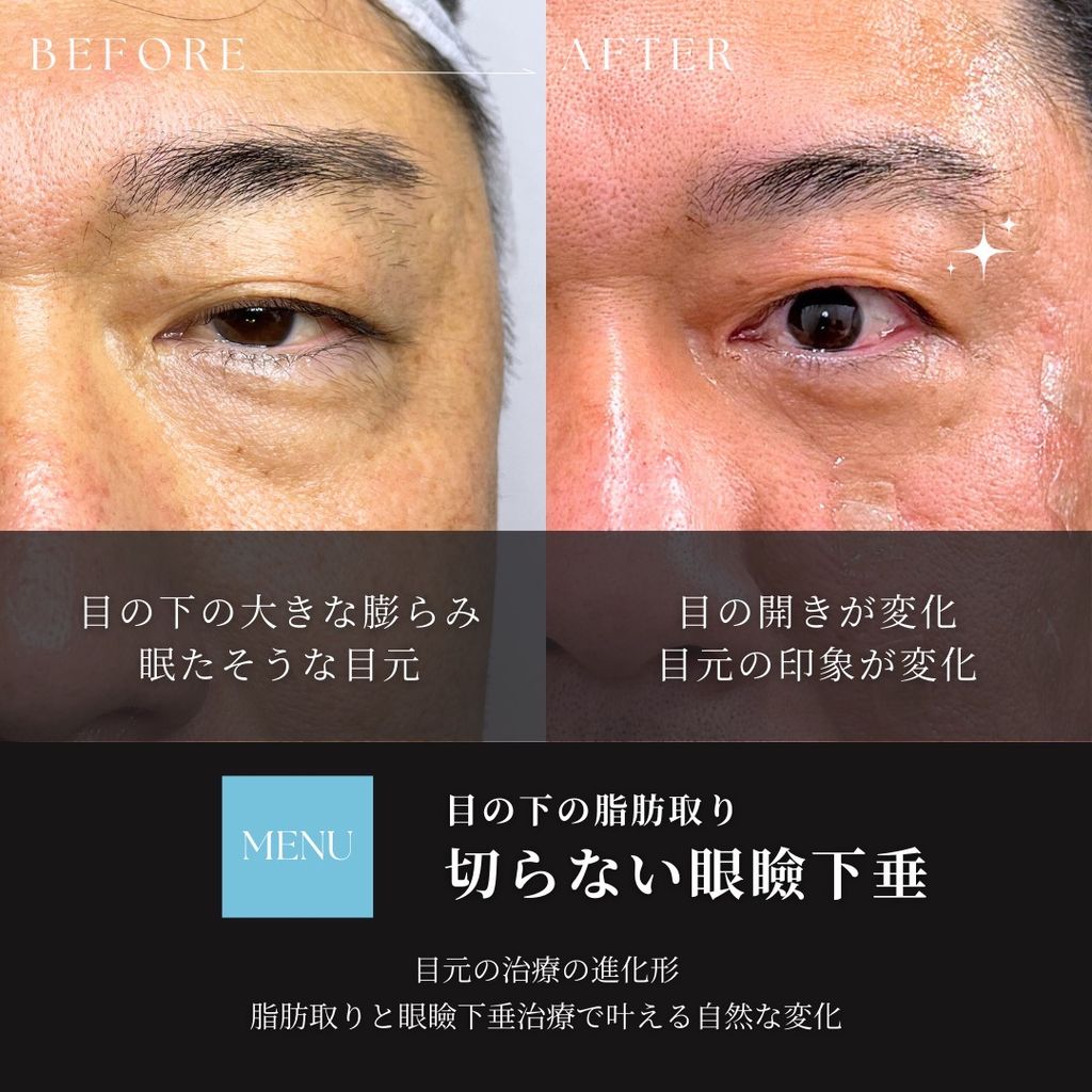 廣瀬003