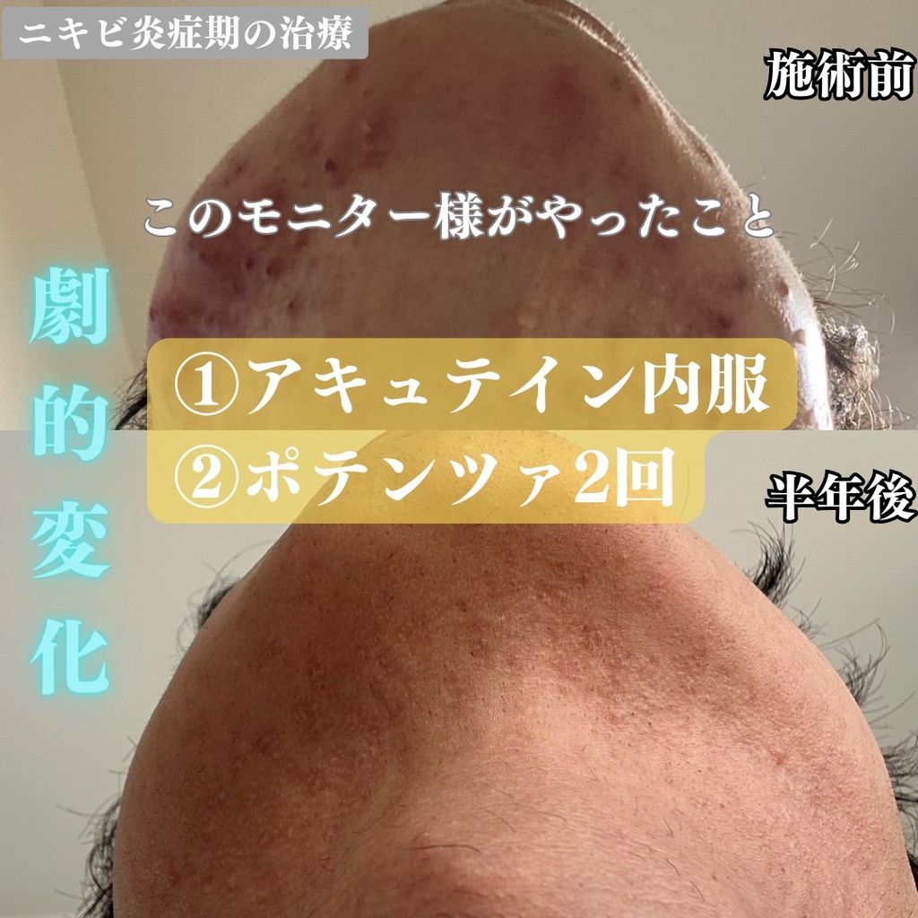 廣瀬004