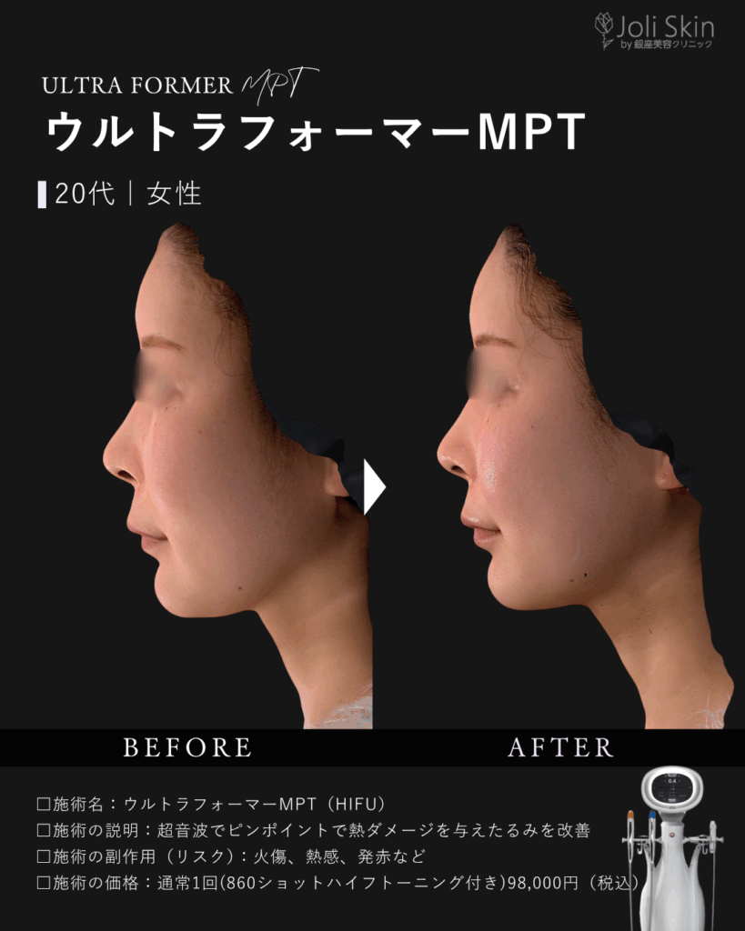 常深003