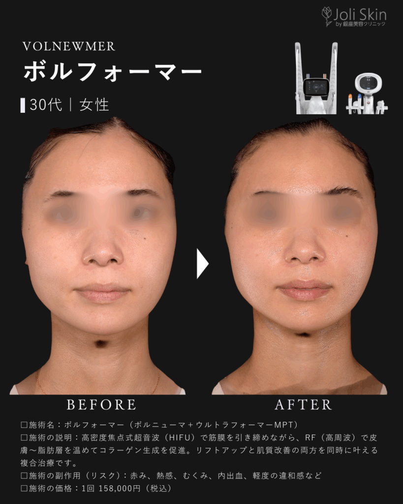常深004