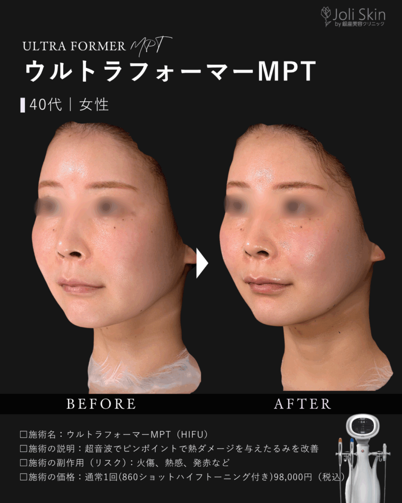 常深005