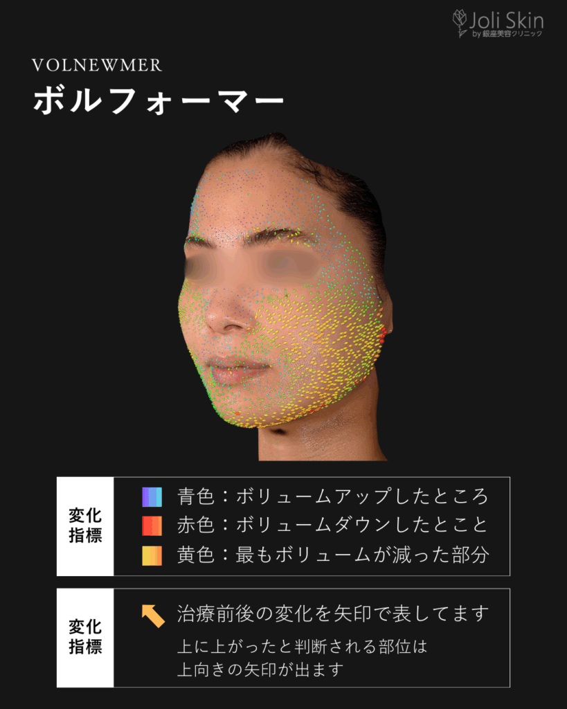 常深006