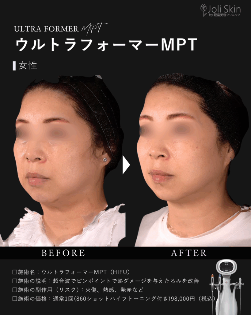 常深007