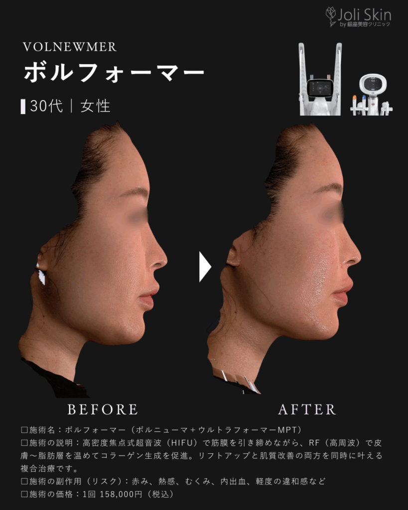常深008