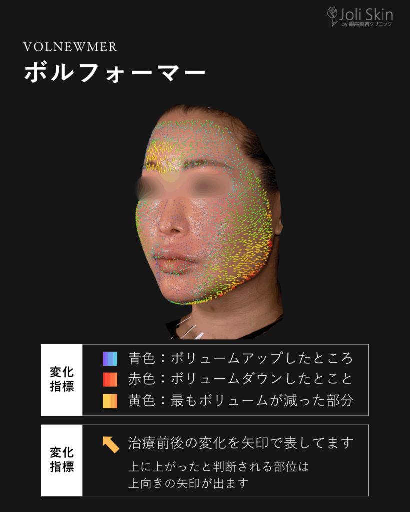 常深009