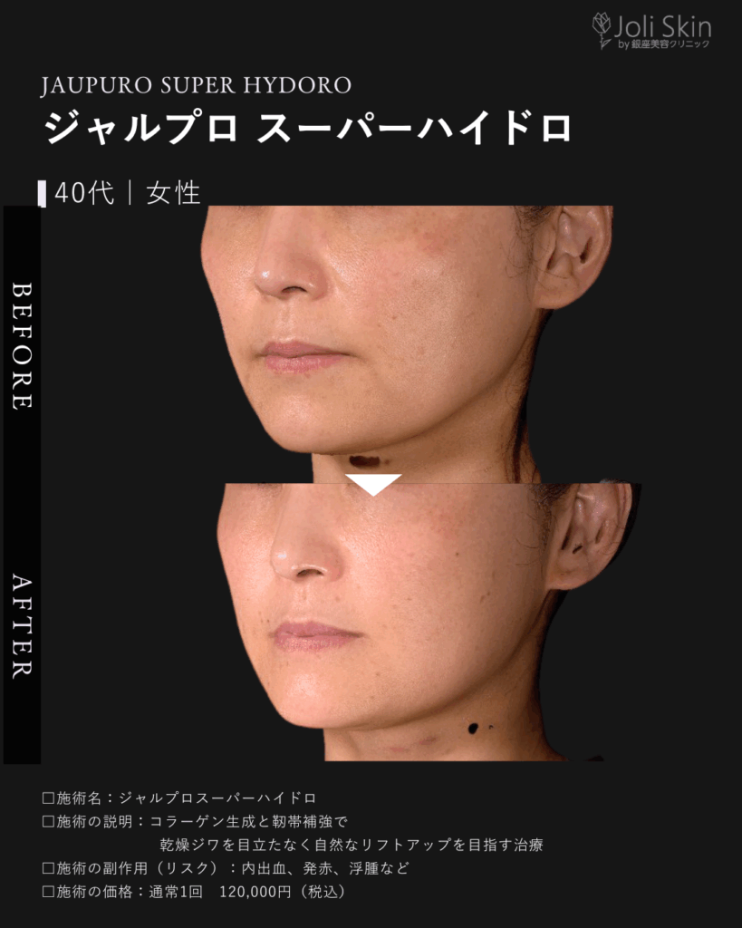 木下003