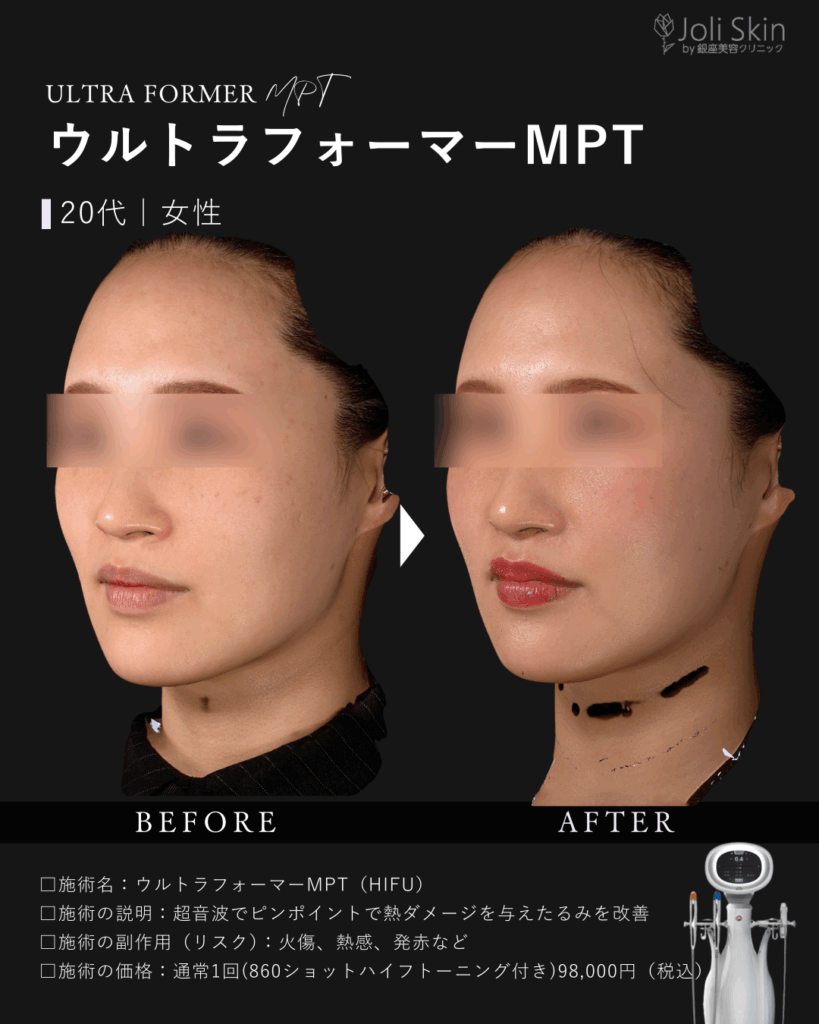 足代002
