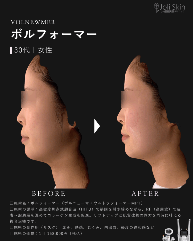 足代003