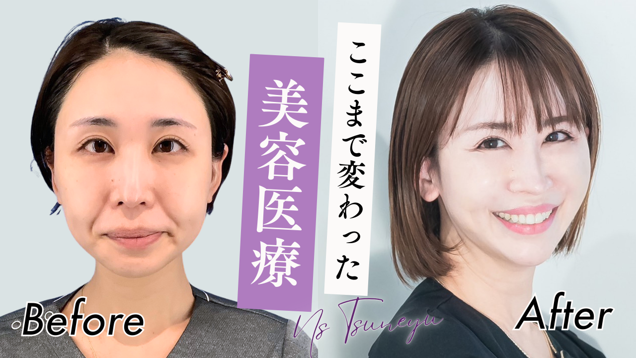 見た目のアンチエイジング 皮膚・容貌・体型の若返りの手法 YouTubeサムネ.png