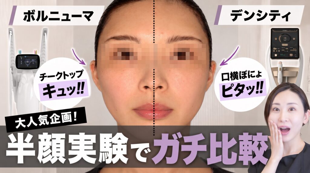【口横のぽにょ肉に効くのは？】デンシティvsボルニューマ！半顔比較で分かった意外な結果